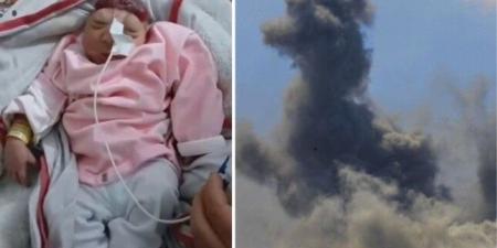ولادة طفلة بلا دماغ مع تزايد ظاهرة "تشوه الأجنة" في قطاع غزة - موقع الآن نيوز