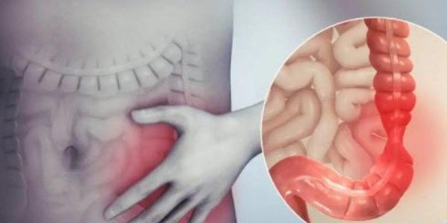 تصيبك بسرطان الأمعاء والقولون.. احترس من تناول هذه الأطعمة ـ موقع الآن نيوز