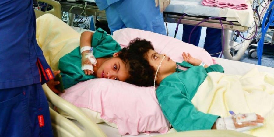 إشادة دولية.. نجاحات كبرى للبرنامج السعودي لفصل التوائم الملتصقة - موقع الآن نيوز